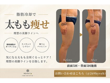 レナータ 銀座店(RENATA)の写真