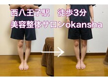 美容整体サロン オオカンシャ(okansha)/O脚矯正