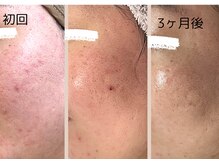 フロート(float)/