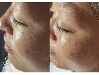 スパークル/フェイシャル/ワックス/小顔