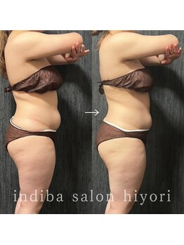 ヒヨリ(hiyori)/《before/after》body