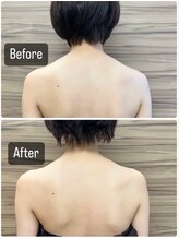 サロン ド レーヴ(Salon de Reve)/【お客様の事例】Billy’s Care