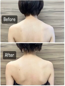 サロン ド レーヴ(Salon de Reve)/【お客様の事例】Billy’s Care