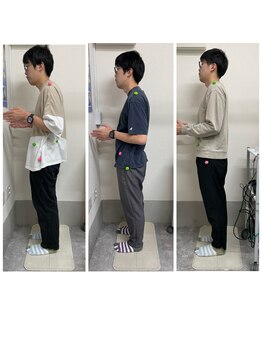 みもざ接骨院/ここまで変わる