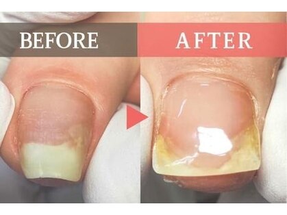 フルフィル 北千住の写真