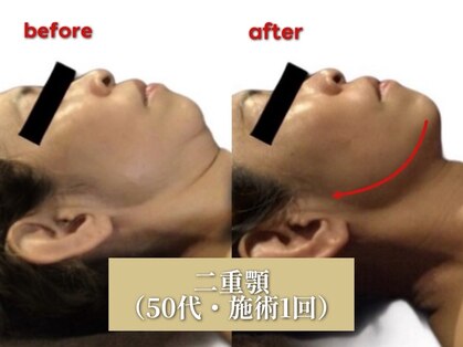 ミクロスポーツ整骨院(MICRO SPORTS整骨院)の写真