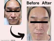 ミネルバエンダモロジー/エンダモロジー/フェイシャル