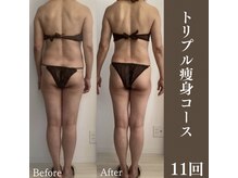 サロンドペシェ(salon de peche)/痩身コース.3ヶ月/11回の変化★