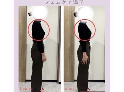 ルナ(Runa)の写真