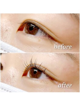 イツミ ヘアーループ(itsumi)/コスメリフト