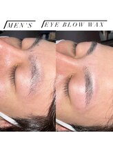 リンクス(links)/ワックス脱毛　メンズ