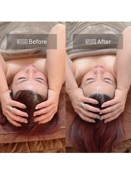 スリージー/before/after