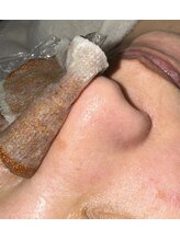 グロウズ(Glows)/毛穴洗浄２