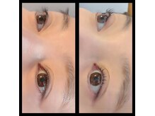 アイタス(eye+)