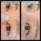 アイタス(eye+)
