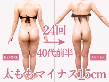 べモーレ 上本町 谷町九丁目(Bemolle)/40代痩身24回ビフォーアフター☆