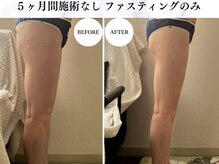 シーフェイス 横浜店(SEE FACE)/エステ+ホームケア(酵素ファス)