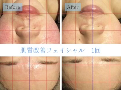 リテルナ(Re.terna)の写真