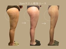 エステティックサロン アールグレー/Neoスリムボディ～脚～