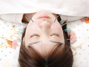 佐藤鍼灸院 美顔鍼プレム(美顔鍼PUREMU)/顔の施術5