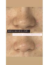 ヴィーナス(Venus)/フェイシャルWAX