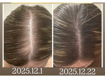 ルマエクレ(rmaecla)/日本でもスタート