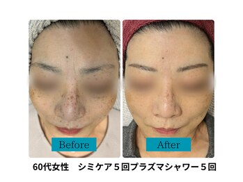 ビジュツ(BIJYUTSU)/