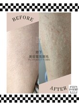 ビー ファクトリー(B FACTORY)/脚