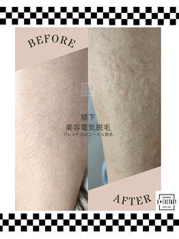 ビー ファクトリー(B FACTORY)/脚