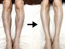 フィズ 浦和店(FIS)の雰囲気（脱毛で清潔感UP！肌悩み改善のフェイシャルメニューもあり）