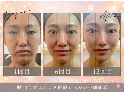 ゴールデンケア(goldencare)の写真