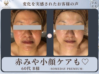 サムデイ プレミアム 新宿西口店(SOMEDAY)/FACE