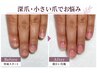 【深爪・むしり爪・小さい爪】自爪育成お試し￥7,700→￥7,000