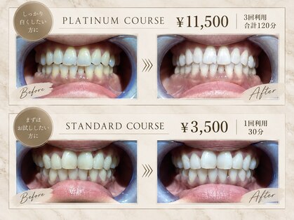 フルーリラ(fleulilas)の写真