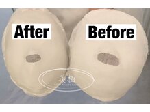 美極 トータルビューティー(美極 TOTAL BEAUTY)/恵比寿/小顔コルギ/エステ/