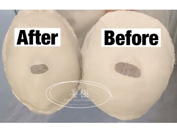 美極 トータルビューティー(美極 TOTAL BEAUTY)/恵比寿/小顔コルギ/エステ/