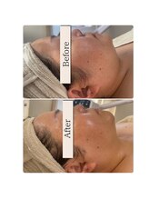 プアラ(puala)/美筋整顔シェービング