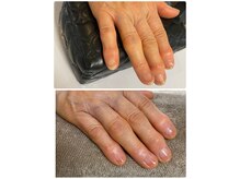 リエル(Liel)/ネイルケアで健康的な爪へ☆