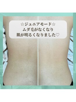 ネクサス(NEXUS)/