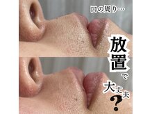 ホワイトワックス 難波店(WHITE WAX)の雰囲気（メンズにも超おすすめ♪髭/産毛/皮脂テカリ/毛穴詰まりサヨナラ!）