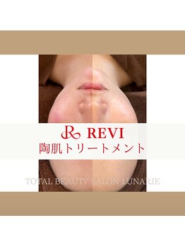 ルナージュ(LUNARJE)/陶肌トリートメント