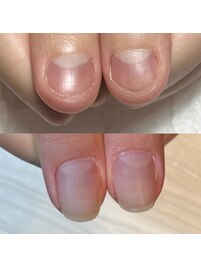 自爪風ジェルネイルの自爪育成