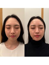 イロドリ 南浦和(irodori)/小顔矯正