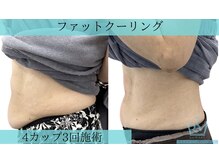 リメイク 広尾(REMAKE)/