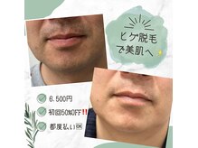 ルグナ(Lugna)の雰囲気(都度払いメニューも豊富◎部位ごとのお得なクーポンもご用意有り)