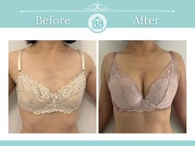 美人バスト 浦和店/【バストアップ★育乳】症例