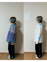 カイロプラティックスタジオ アラインプラス(Align+)/姿勢の崩れが原因かも