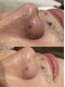 トータルエステサロン ポイント(POINT)の写真/毛穴の黒ずみや開きを徹底的に改善！お肌の汚れを取り除いてニキビケア◎透明感のある毛穴レスなツヤ肌に♪