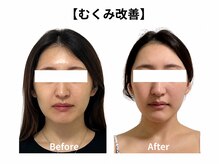 クローバー(clover)の雰囲気（小顔ケアでむくみを流しスッキリしたフェイスラインを実現）