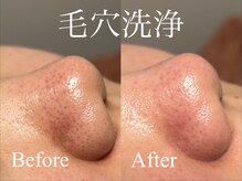 アース 松本庄内店(HAIR & MAKE EARTH)の雰囲気（ SNSで話題♪毛穴洗浄で黒ずみ・角栓をごっそりケア！5500円）